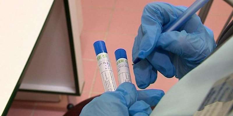 На Орловщине умер еще один мужчина с диагнозом COVID-19