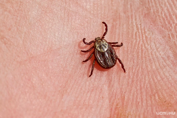 В Орловской области зарегистрирован 1 случай иксодового клещевого боррелиоза