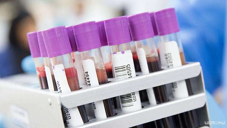 Новые данные по COVID: на Орловщине число летальных случаев возросло до 88