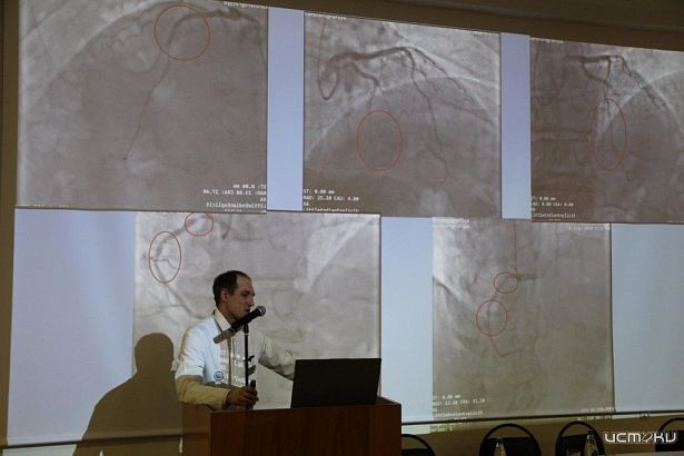 Врачи из больницы им. Семашко провели в прямом эфире операцию на сердце 