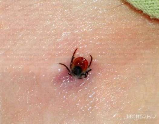 Клещи атакуют жителей Орловской области