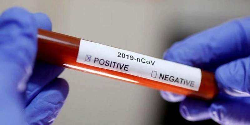 На Орловщине скончались ещё шесть человек с коронавирусом