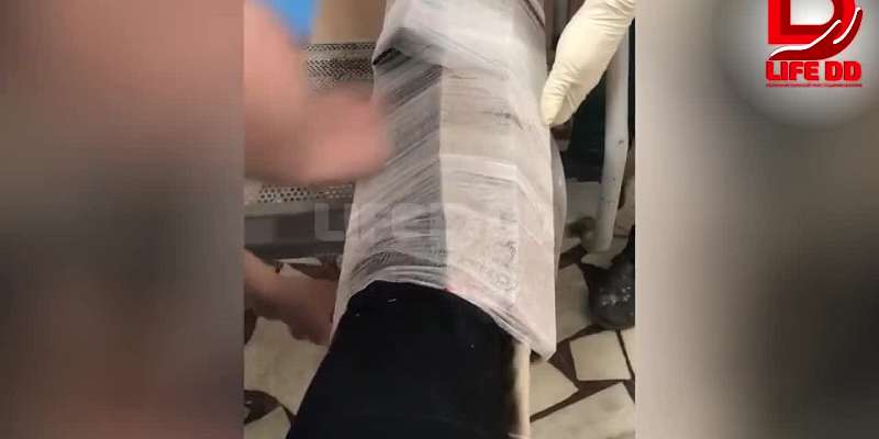 В Орле в больнице им. Семашко девушке с переломом ноги наложили гипс из картона