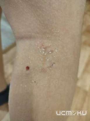 В Орле стая собак пыталась растерзать ребёнка