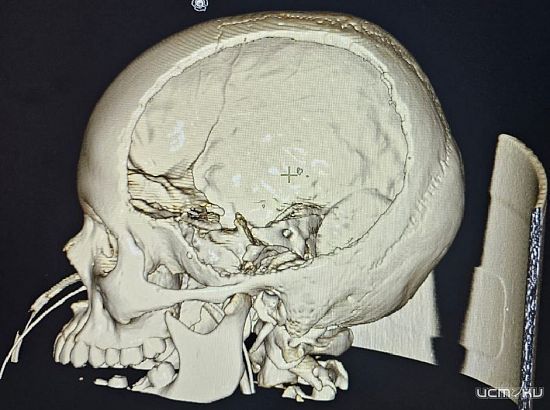 Орловские врачи спасли ребенка с редким заболеванием