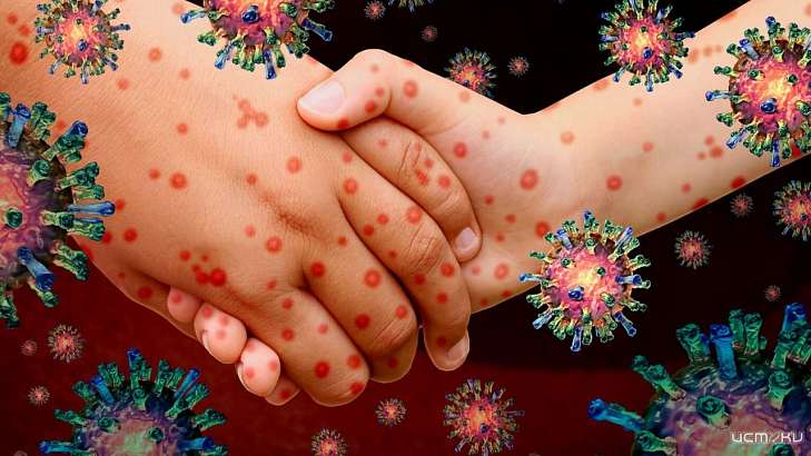 Жителя Орловской области положили в больницу с подозрением на корь