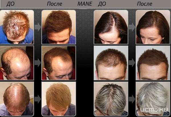 Загустители для волос: особенности и преимущества использования